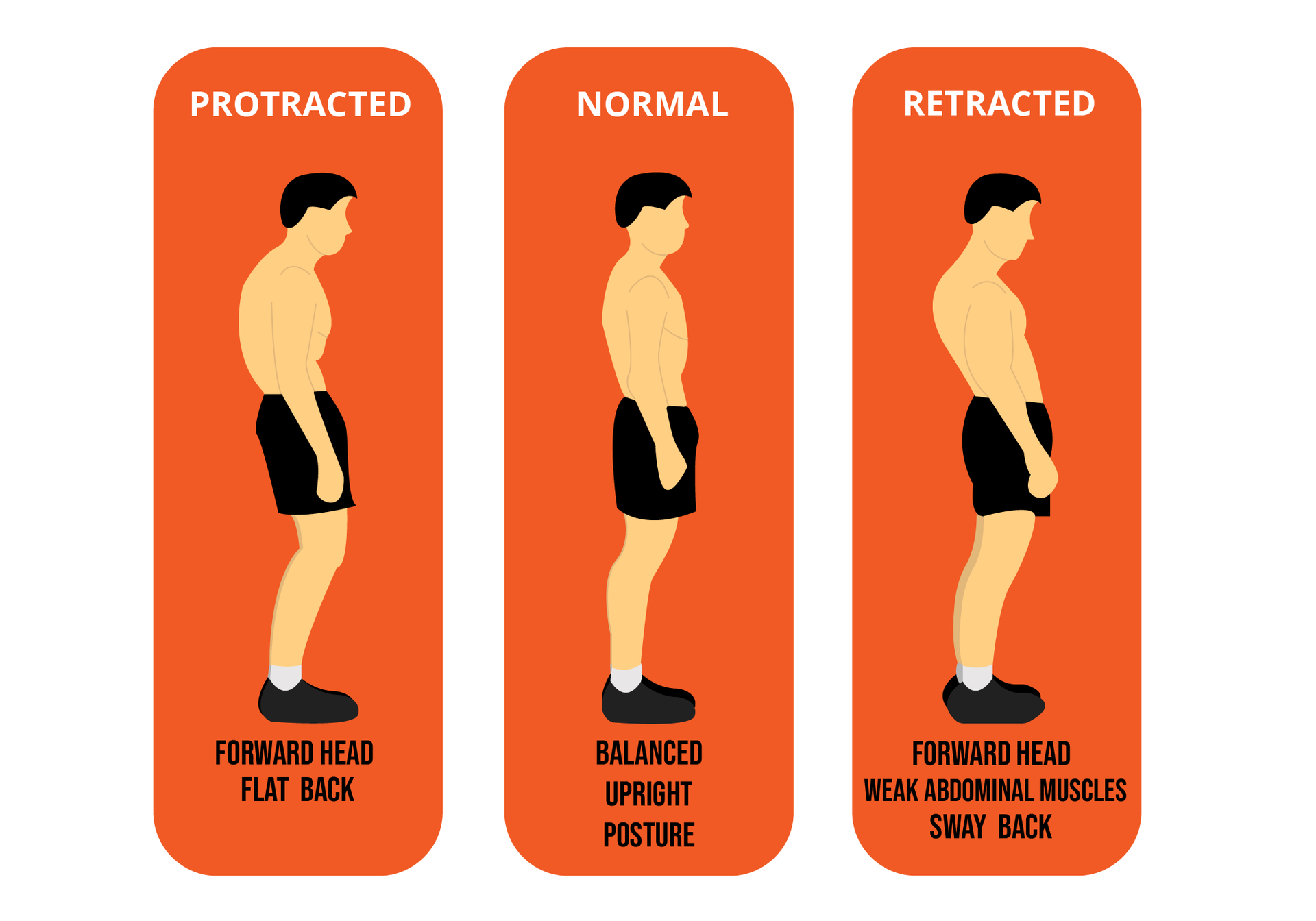 Postural Assessment: Guide for Fitness Professionals